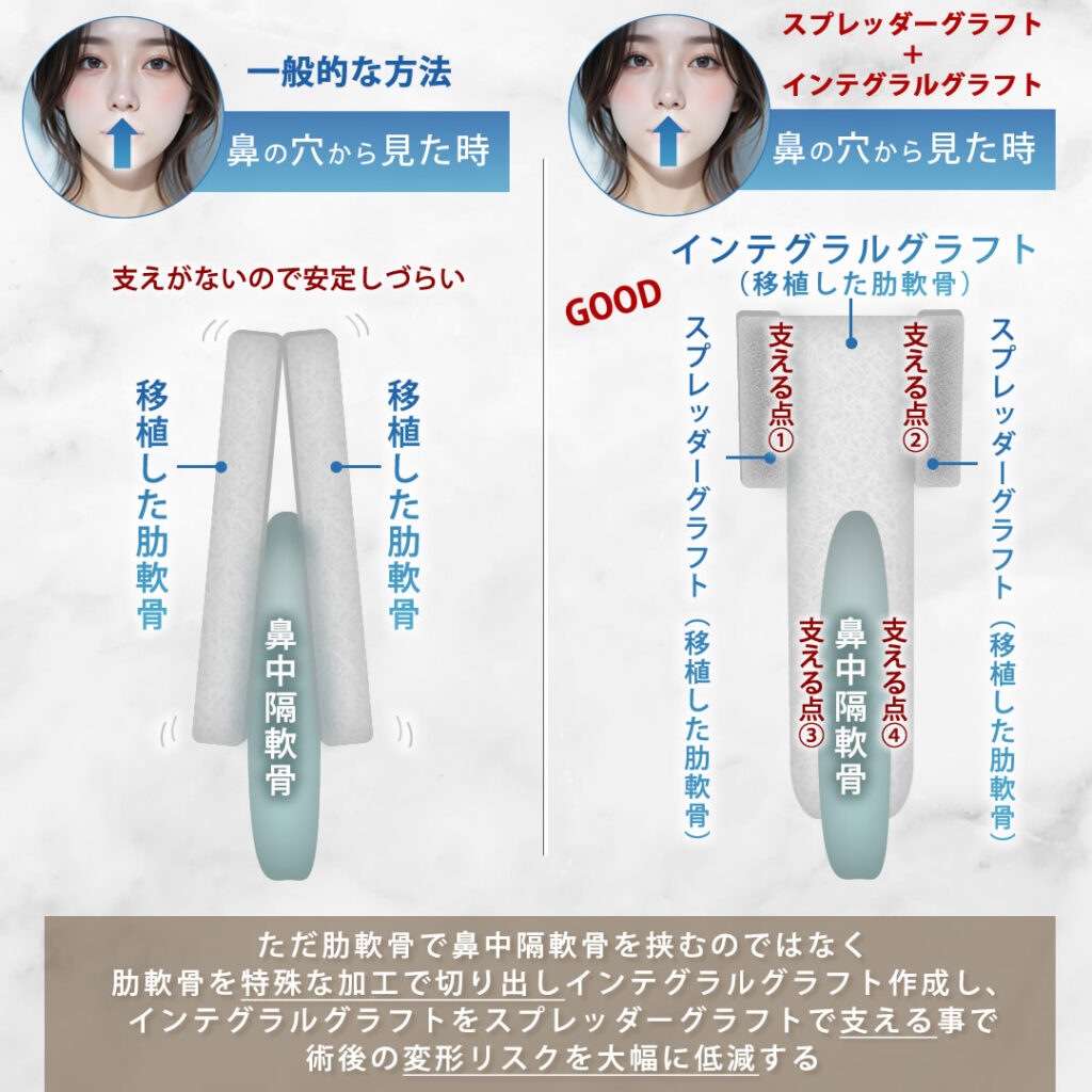 一般的な方法とインテグラルクラフトとスプレッダークラフトを組み合わせた方法の図解