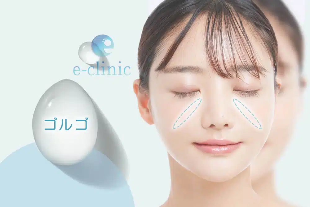 ゴルゴライン