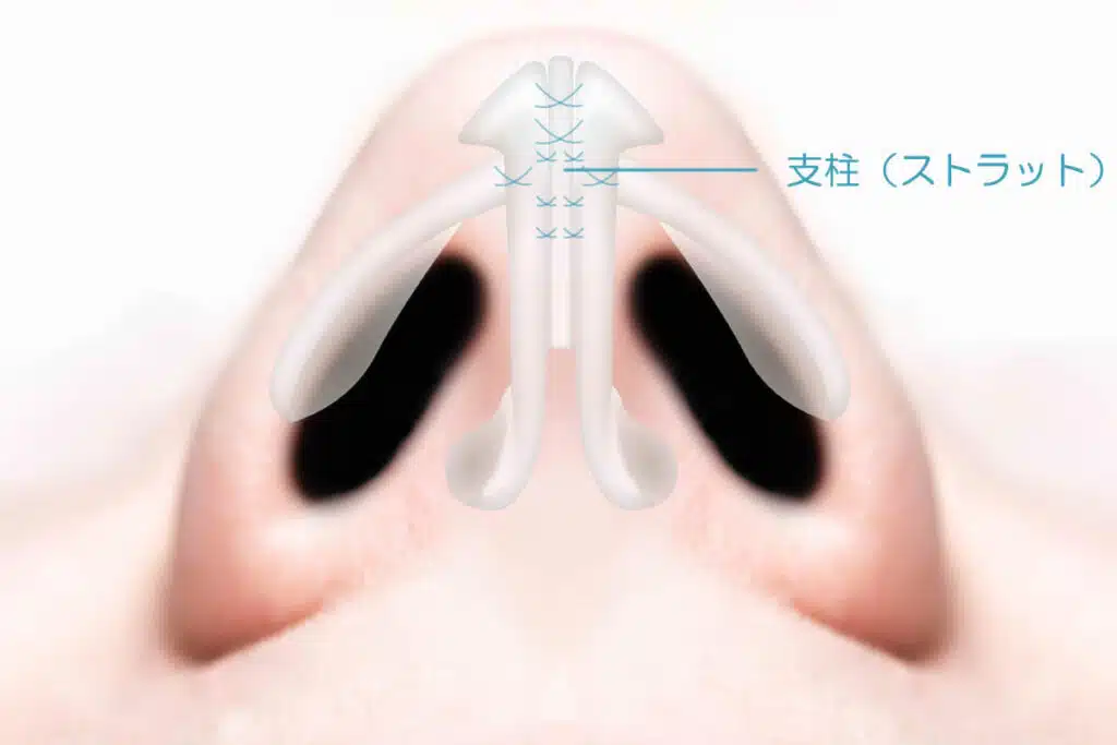 鼻尖形成