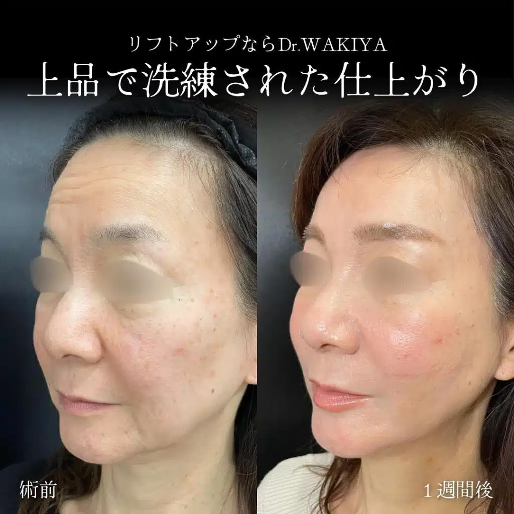 上品で洗練された仕上がり　岡山