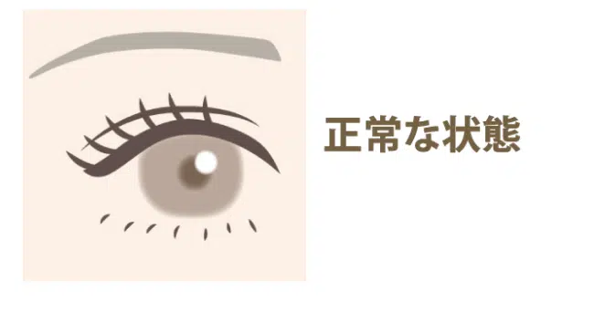 正常な目　岡山