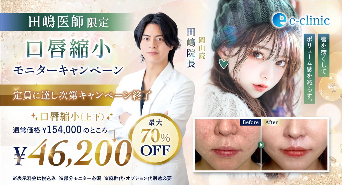 田嶋医師唇縮小キャンペーン画像