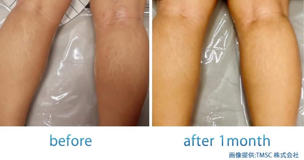 リジェネラの症例写真 (1)