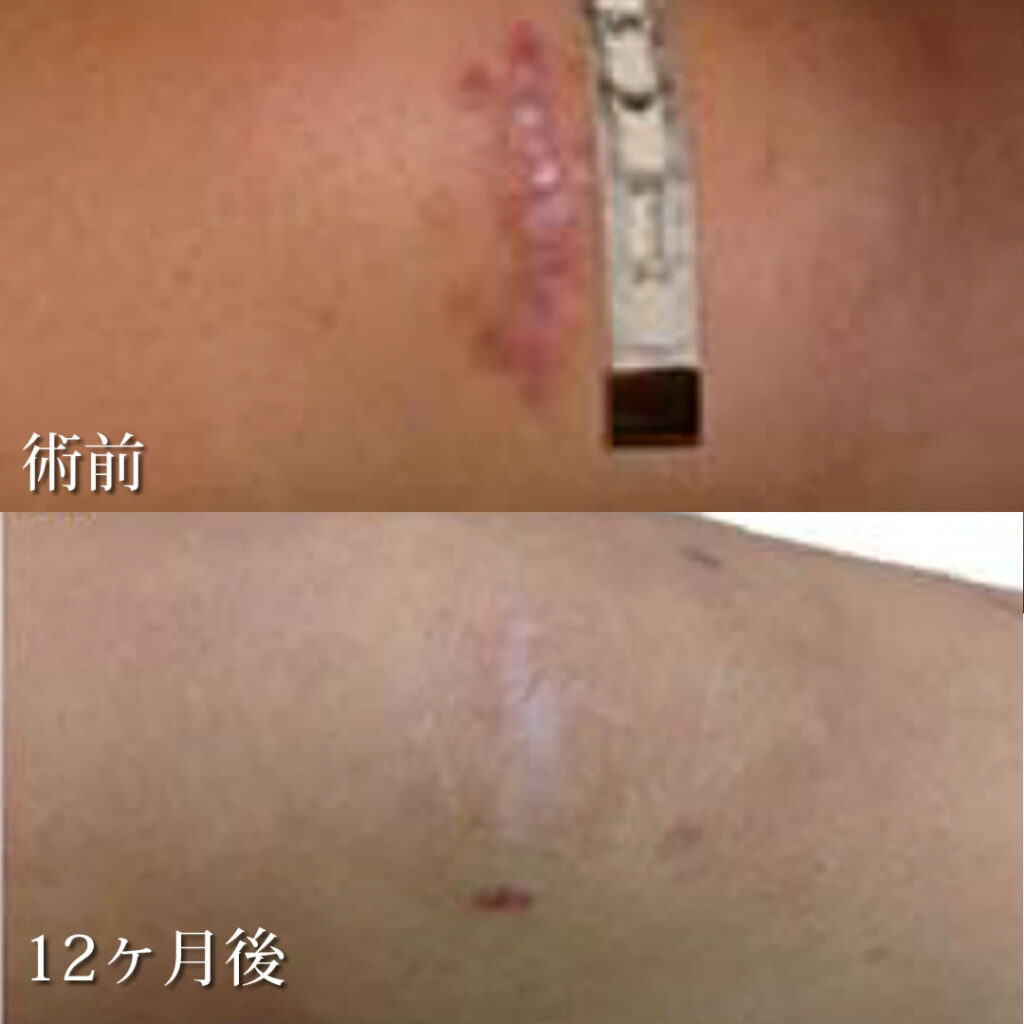 リジェネラの症例写真