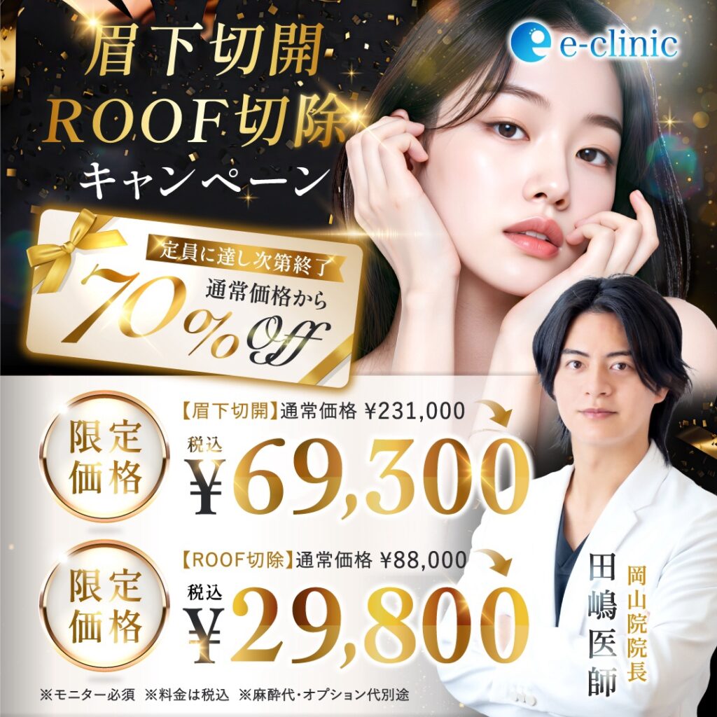 眉下切開・ROOF切除のキャンペーンバナー (2)