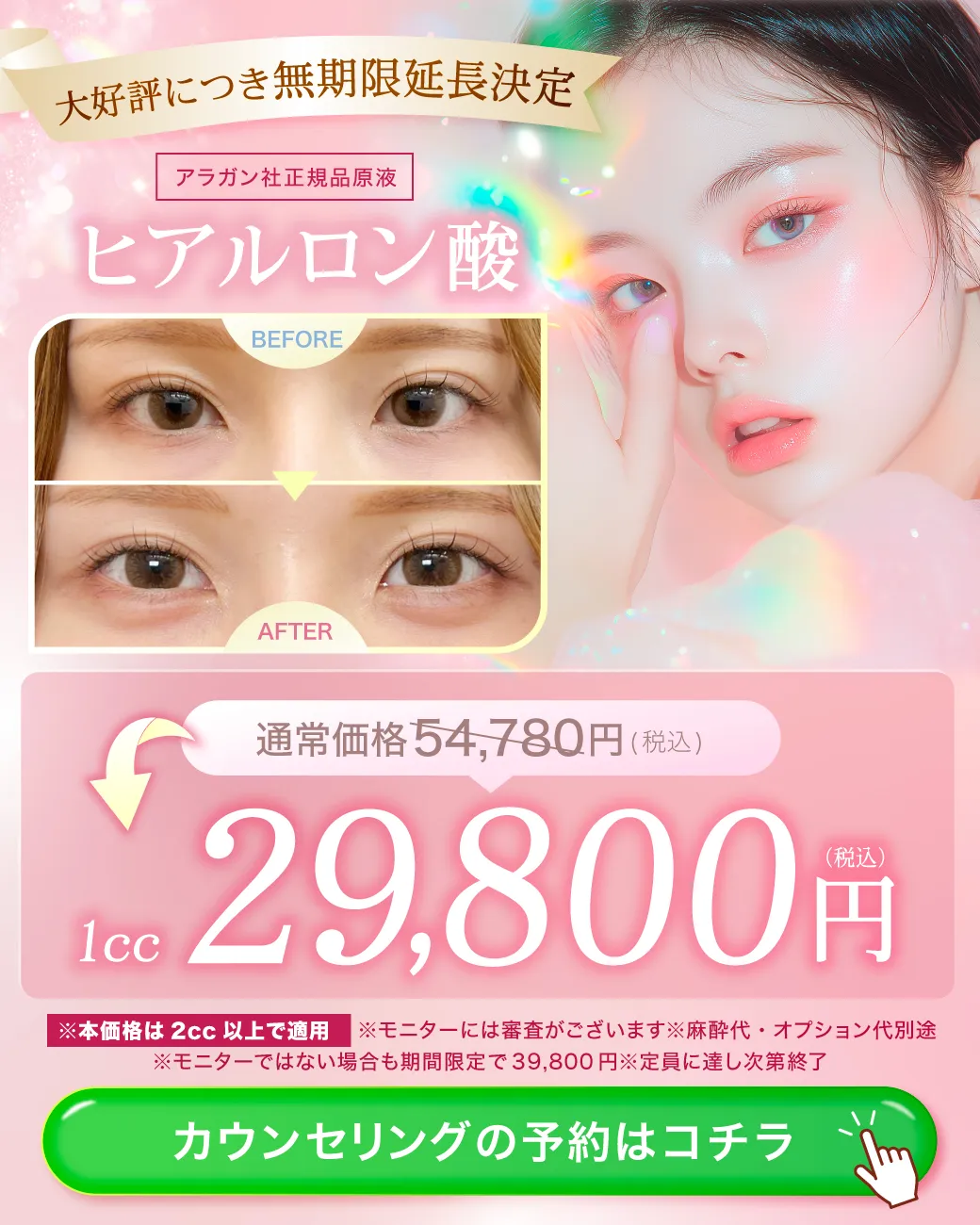 閑散期ヒアルロン酸CP